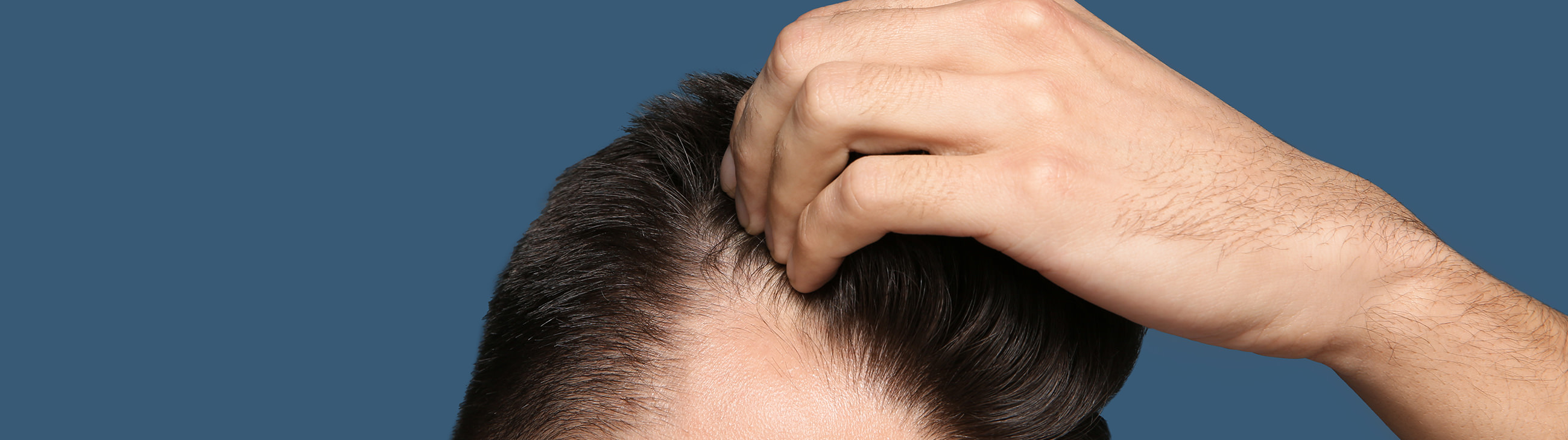 Eczema on the scalp