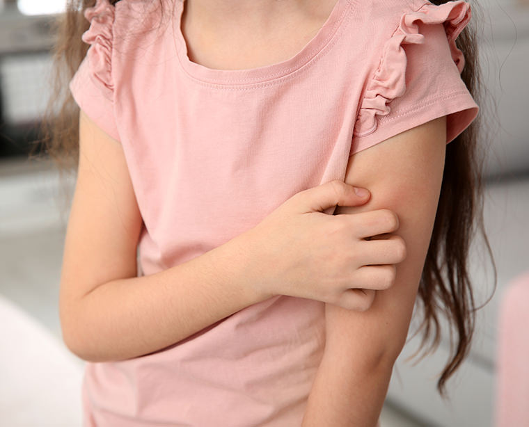 Eczema in children: everything you need to know